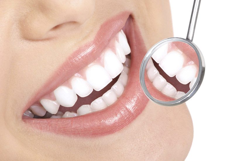 Dr. Oz te învață cum să-ți albești dinții rapid și ieftin