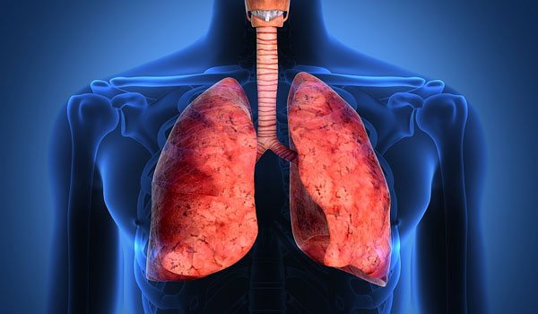 cancerul-pulmonar