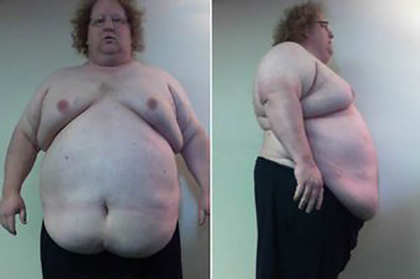 A slăbit 135 de kilograme în doar 15 luni cu un simplu TRUC! Cum arată acum acest bărbat