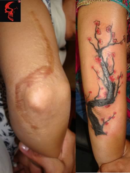 tatuaje care ascund perfect cicatricile 14