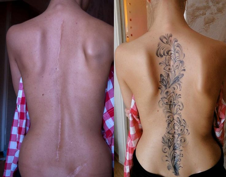 tatuaje care ascund perfect cicatricile 27