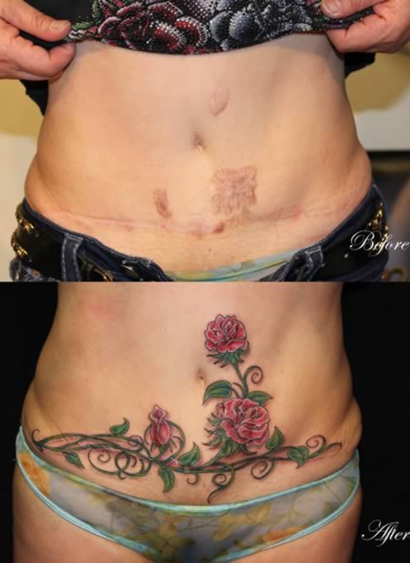 tatuaje care ascund perfect cicatricile 9