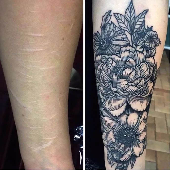 tatuaje care ascund perfect cicatricile