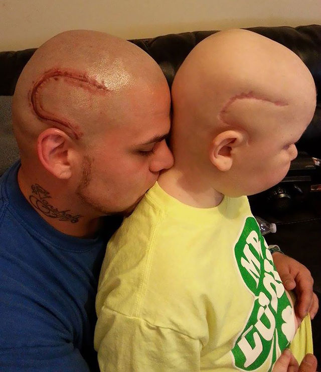 Gestul uimitor al unui tata care si-a tatuat cicatricea fiului sau bolnav de cancer.