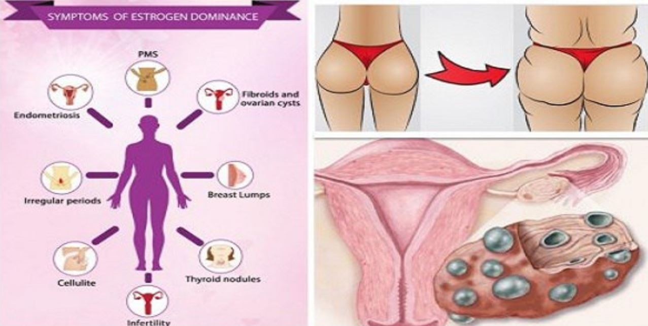 Dominanta de estrogen poate fi o problemă gravă provocată de lipsa nutrienților în organism