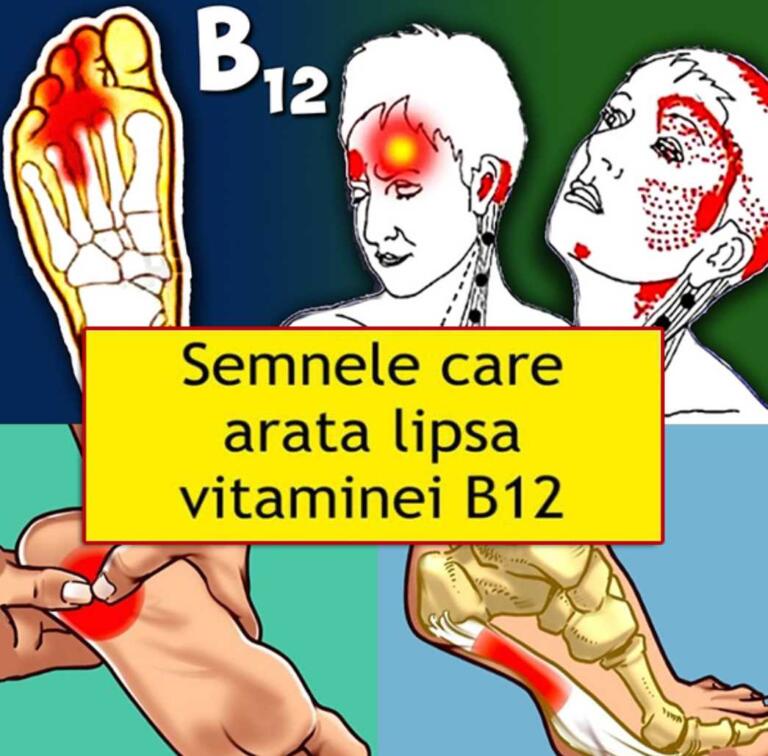 Descopera simptomele surprinzatoare ale deficientei de vitamina b12